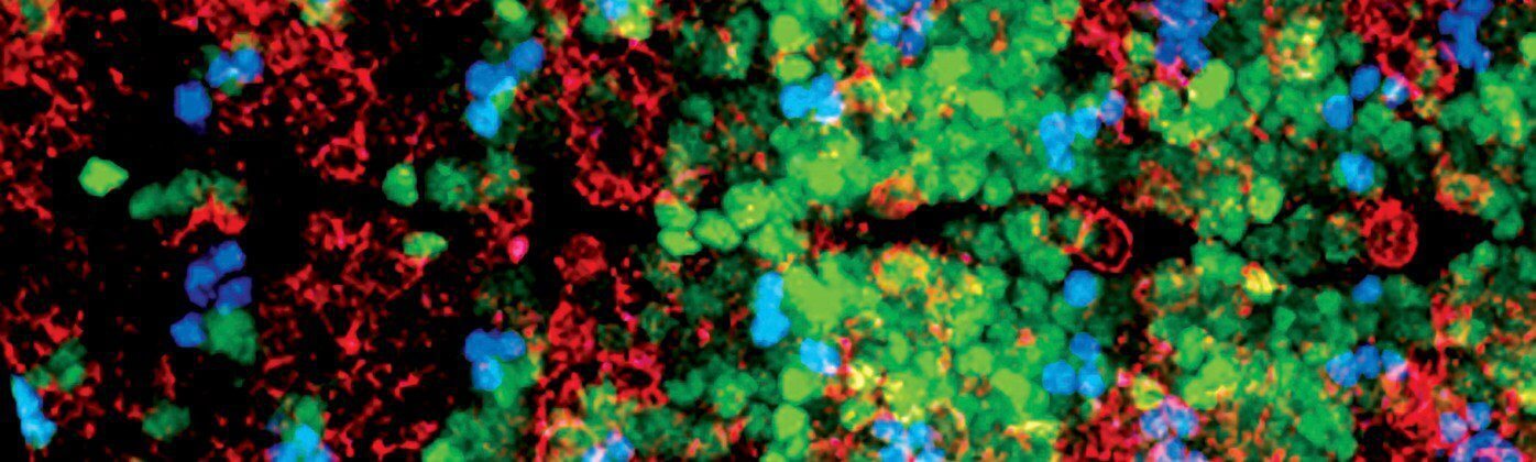 Cell-Free Protein Synthesis